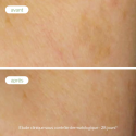 Soin ciblé correcteur de taches - Novexpert