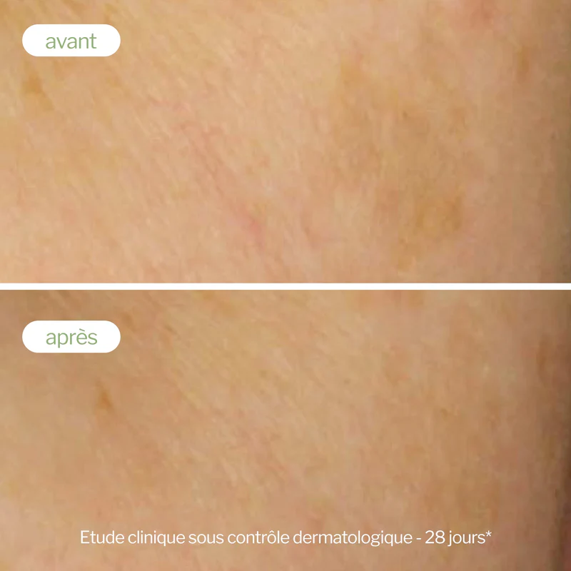 Soin ciblé correcteur de taches - Novexpert